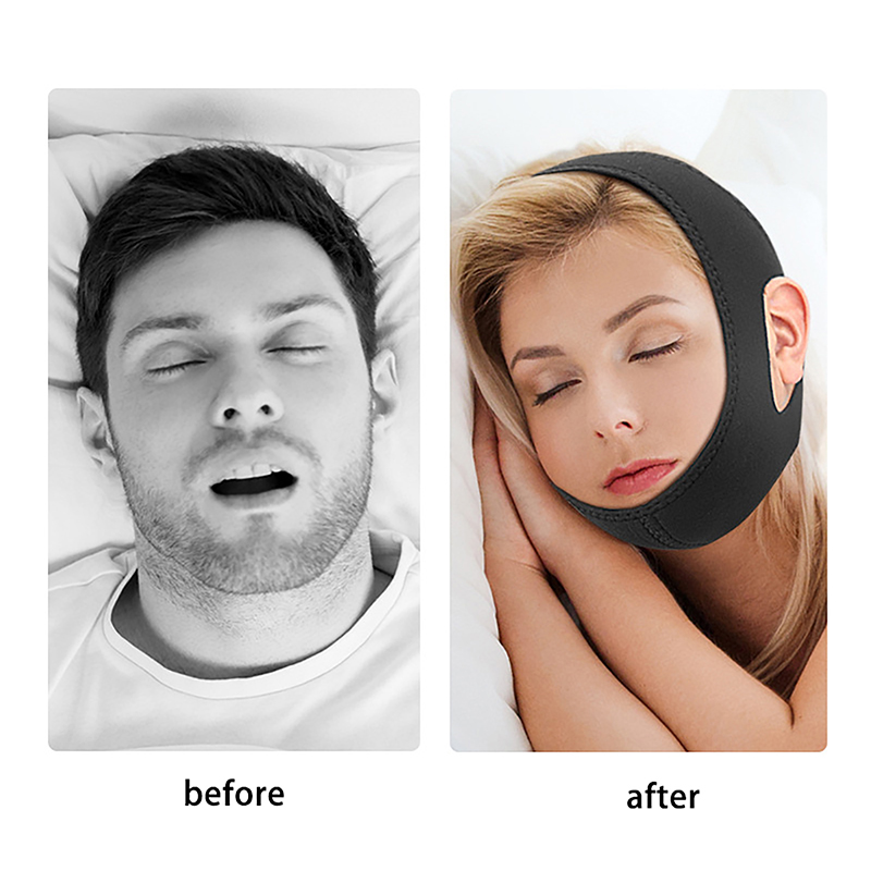 Anti Snore Chin Strap Adjustable - สายรัดนีโอพรีนปรับได้ ป้องกันการนอนกรน สายรัดคาง ป้องกันการนอนกรน ที่ครอบปาก ป้องกันการนอนกรน